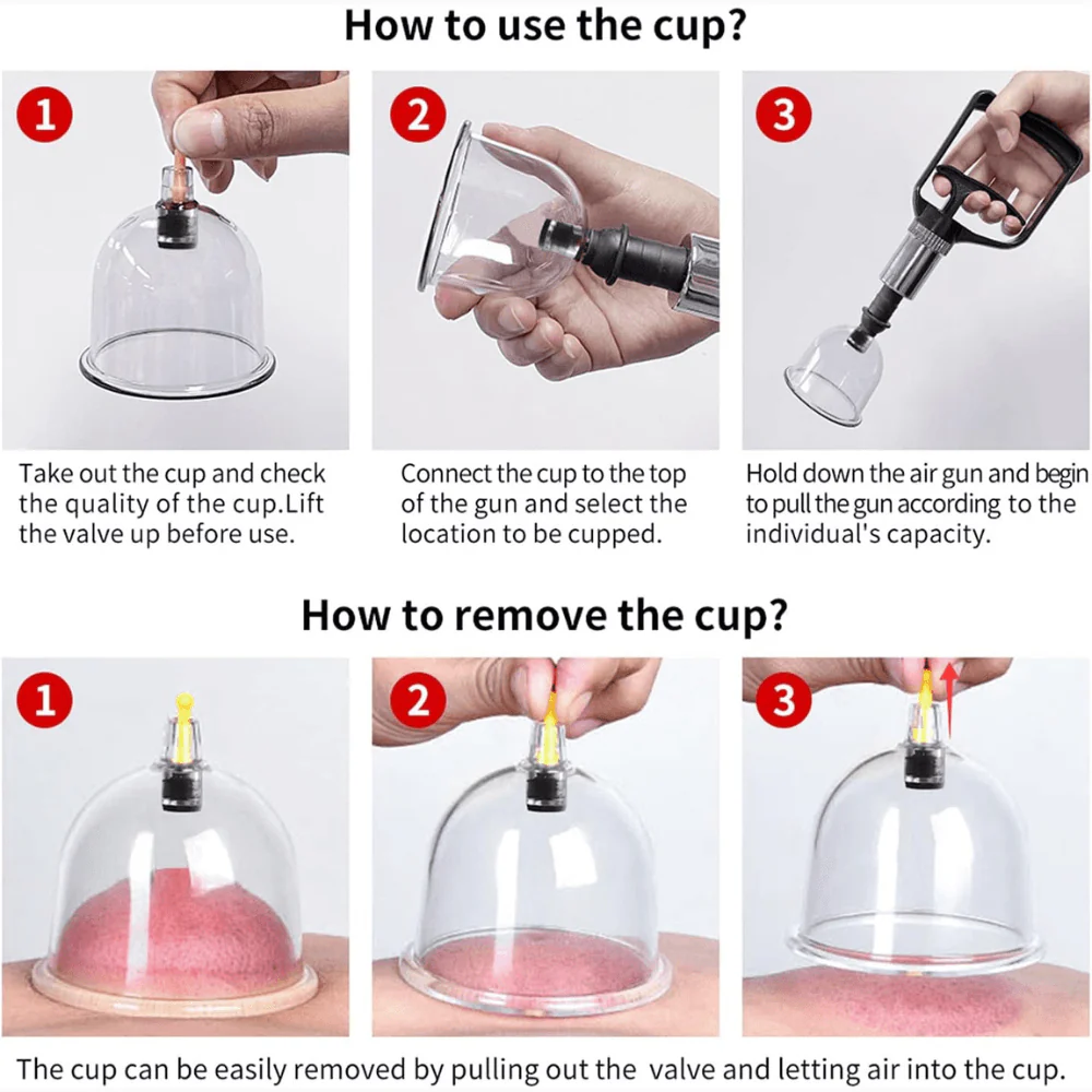 Kylin Professional Cupping Therapy 24pc Set - Image 3